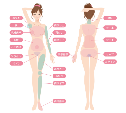 大阪・難波の医療全身脱毛でヴィーナスヴェロシティを導入している桜川よしえクリニックの女性脱毛部位