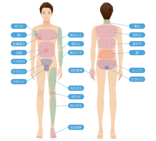 大阪・難波の医療全身脱毛でヴィーナスヴェロシティを導入している桜川よしえクリニックの男性脱毛部位